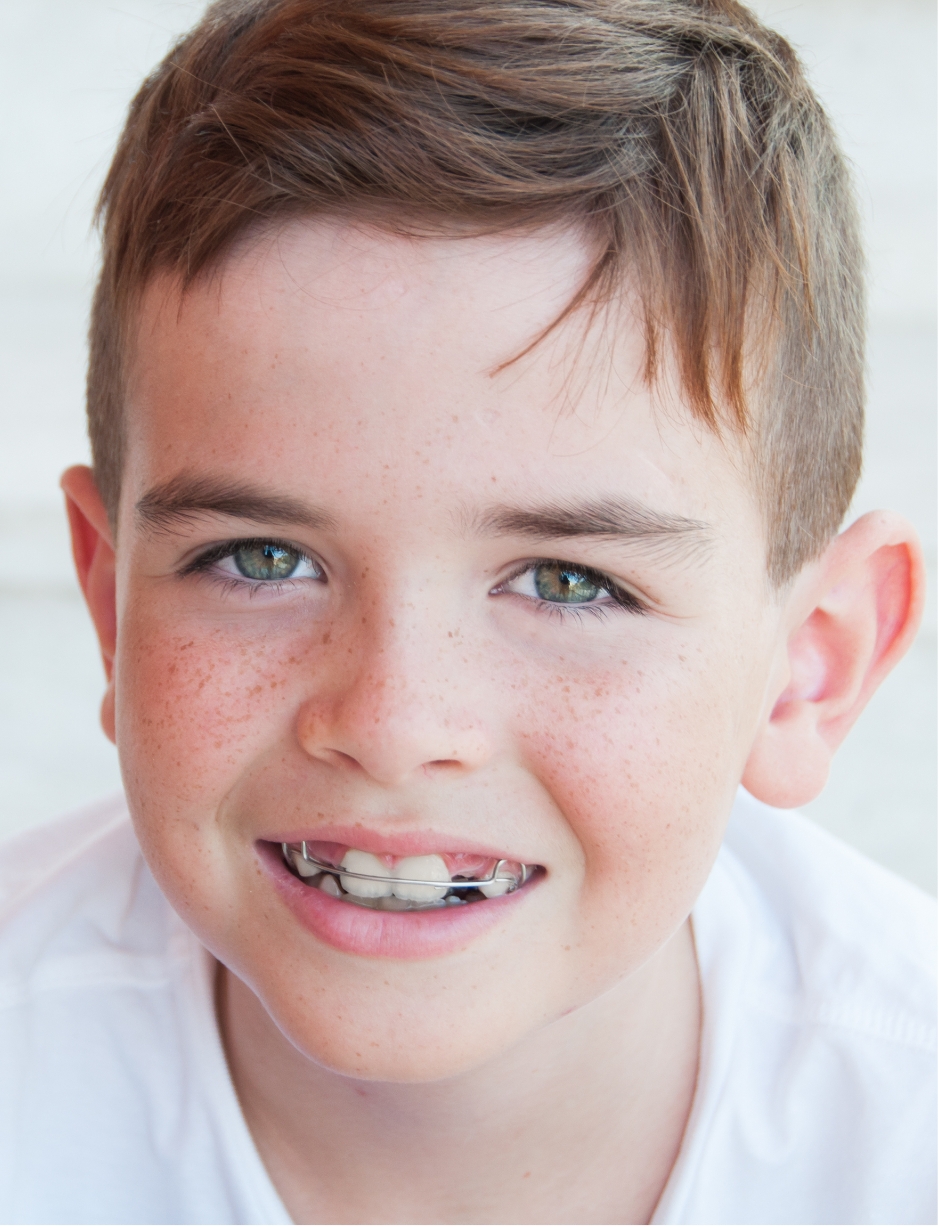 an image of a child with orthodontic braces