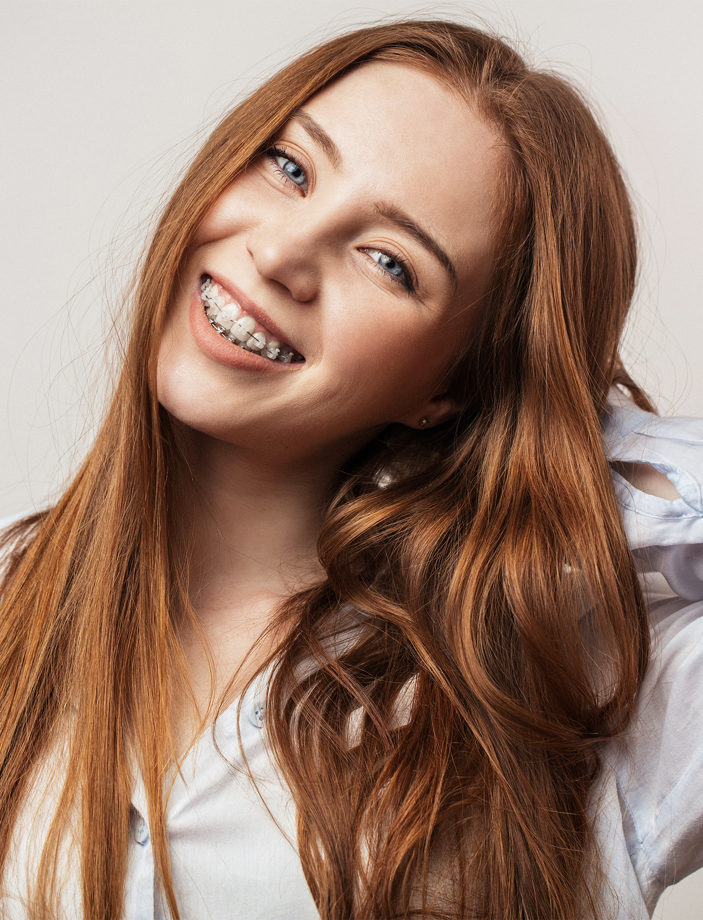 a teenager wearing braces from Alain Cyr Orthodontics, showcasing the dental clinic's expertise in orthodontic care