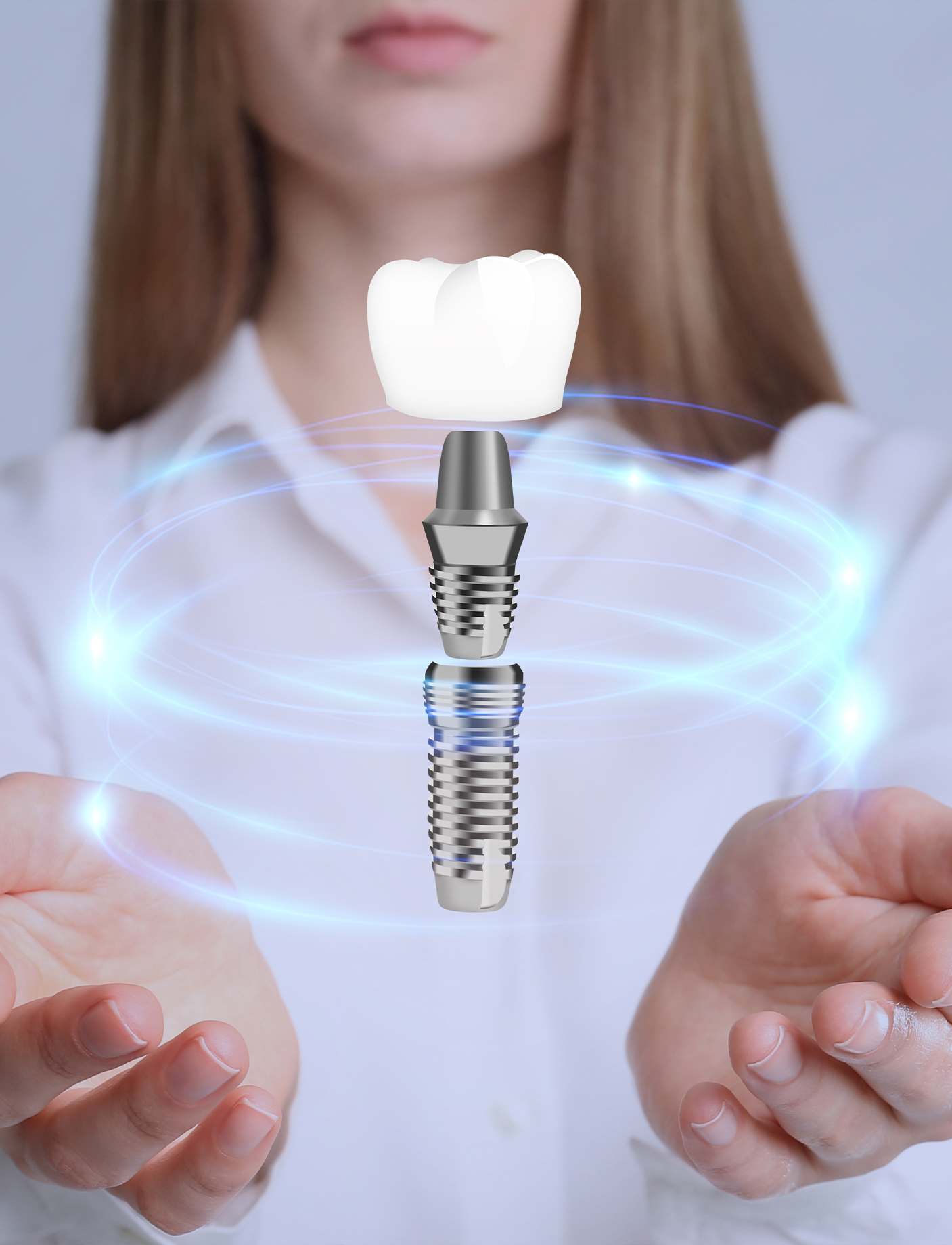 an image of a modern dental implant